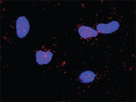 Anti-RET + PLCG1 Antibody Pair