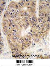 Anti-SUMO4, mutant Rabbit Polyclonal Antibody (HRP (Horseradish Peroxidase))