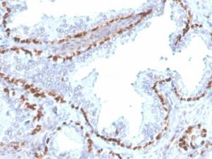 Immunohistochemical analysis of formalin-fixed, paraffin-embedded human kidney using Anti-p40 Antibody [rTP40/3690]