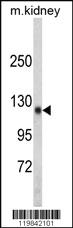 Anti-TSHZ1 Rabbit Polyclonal Antibody