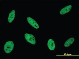 Anti-CDKL1 Mouse Monoclonal Antibody [clone: 5B11]