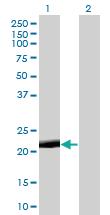 Anti-PAGE4 Mouse Monoclonal Antibody [clone: 7C3]