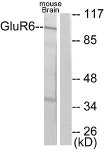 Western blot analysis of lysates from mouse brain using Anti-mGluR6 Antibody. The right hand lane represents a negative control, where the Antibody is blocked by the immunising peptide