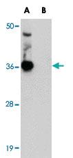 Anti-GID8 Rabbit Polyclonal Antibody