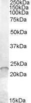 Anti-ASF1A Antibody (A84347) (0.01µg/ml) staining of Jurkat cell lysate (35µg protein in RIPA buffer). Primary incubation was 1 hour. Detected by chemiluminescence.