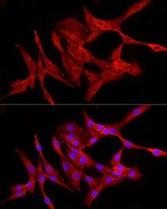 Immunofluorescence analysis of NIH/3T3 cells using Anti-NF-kB p65 Antibody (A309933) at a dilution of 1:100 (40x lens). DAPI was used to stain the cell nuclei (blue).