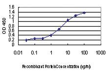 Anti-CDKL1 Mouse Monoclonal Antibody [clone: 5B11]