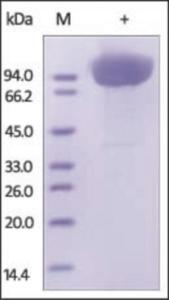 The purity of rh CD31 was determined by DTT-reduced (+) SDS-PAGE and staining overnight with Coomassie Blue.