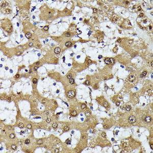 Immunohistochemistry analysis of paraffin-embedded human liver using Anti-MAK Antibody (A308925) at a dilution of 1:100 (40x lens). Perform microwave antigen retrieval with 10 mM PBS buffer pH 7.2 before commencing with IHC staining protocol.