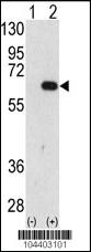 Anti-AMFR Rabbit Polyclonal Antibody