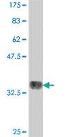 Anti-UBE2D1 Mouse Polyclonal Antibody