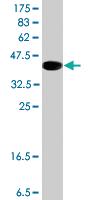 Anti-CSDE1 Mouse Polyclonal Antibody