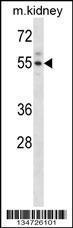 Anti-ACVR2A Rabbit Polyclonal Antibody (HRP (Horseradish Peroxidase))