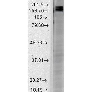 Western blot analysis of rat brain membrane lysate showing detection of SHANK2 protein using Anti-SHANK2 Antibody [N23b/6] (A304814) at 1:1000 for 2 hours at room temperature