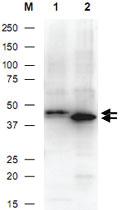 Anti-His tag Polyclonal Antibody