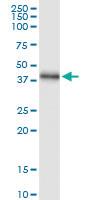 Anti-NEIL2 Polyclonal Antibody Pair