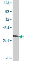 Anti-DCAF10 Mouse Polyclonal Antibody