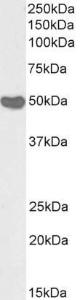 Anti-CREB3L4 Antibody (A82757 / Biotin) (1µg/ml) staining of Human Placenta lysate (35µg protein in RIPA buffer), exactly mirroring its parental non-biotinylated product. Primary incubation was 1 hour.