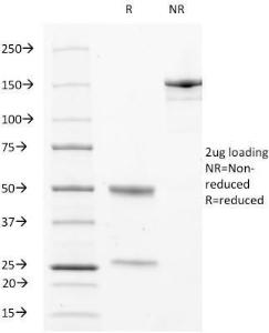 SDS-PAGE analysis of Anti-CD63 Antibody [LAMP3/529] under non-reduced and reduced conditions; showing intact IgG and intact heavy and light chains, respectively. SDS-PAGE analysis confirms the integrity and purity of the antibody