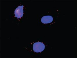 Anti-RXRA + RARA Antibody Pair