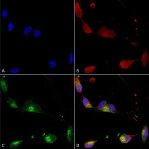 Immunocytochemistry/Immunofluorescence analysis of human neuroblastoma cells (SH-SY5Y), fixed in 4% PFA for 15 min, using Anti-SHANK2 Antibody [N23b/6] (A304814), at 1:100 for overnight at 4°C with slow rocking