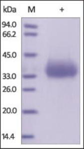 The purity of rh CD2 was determined by DTT-reduced (+) SDS-PAGE and staining overnight with Coomassie Blue.