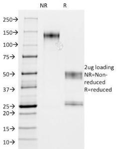 SDS-PAGE analysis of Anti-MUC1 Antibody [GP14 + E29] under non-reduced and reduced conditions; showing intact IgG and intact heavy and light chains, respectively SDS-PAGE analysis confirms the integrity and purity of the antibody