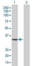 Anti-ADAMTS4 Mouse Polyclonal Antibody