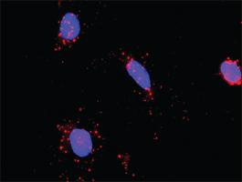 Anti-CAMK2G + SMAD3 Antibody Pair