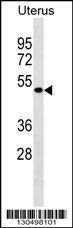 Anti-IDAS Rabbit Polyclonal Antibody (APC (Allophycocyanin))