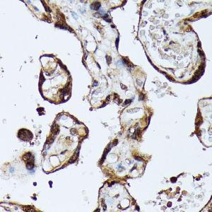 Immunohistochemistry analysis of paraffin-embedded human placenta using Anti-MAK Antibody (A308925) at a dilution of 1:100 (40x lens). Perform microwave antigen retrieval with 10 mM PBS buffer pH 7.2 before commencing with IHC staining protocol.