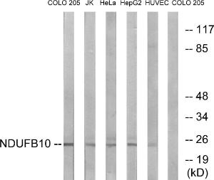 Antibody anti-NDUFB10 100 µg