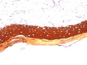 Immunohistochemical analysis of formalin-fixed, paraffin-embedded human skin using Anti-Keratin 77 Antibody [KRTL/1077]