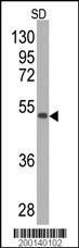 Anti-SOD2 Mouse Monoclonal Antibody [clone: 10i73]