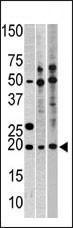 Anti-RPL23A Rabbit Polyclonal Antibody (HRP (Horseradish Peroxidase))