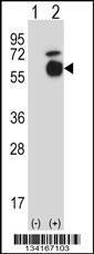 Anti-ACVR1 Rabbit Polyclonal Antibody (APC (Allophycocyanin))