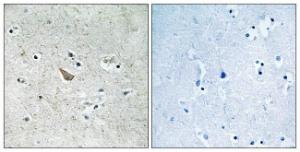 Immunohistochemical analysis of paraffin-embedded human brain using Anti-Ephrin B1 + B2 (phospho Tyr329) Antibody. The right hand panel represents a negative control, where the antibody was pre-incubated with the immunising peptide