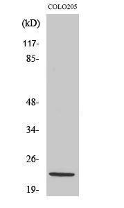 Antibody anti-NDUFB10 100 µg