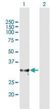 Anti-ADAMTS4 Rabbit Polyclonal Antibody