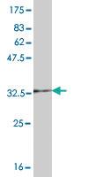 Anti-UBE2D1 Mouse Monoclonal Antibody [clone: 2C6]