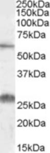 EB09191 (0.1 µg/ml) staining of Human Kidney lysate (35 µg protein in RIPA buffer). Primary incubation was 1 hour. Detected by chemiluminescence.