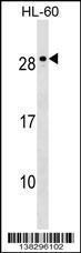 Anti-MED18 Rabbit Polyclonal Antibody