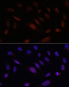 Anti-Bcl9 antibody