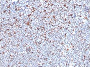 Immunohistochemical analysis of formalin-fixed, paraffin-embedded human tonsil using Anti-MSH6 Antibody [MSH6/3085]