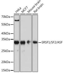 Western blot analysis of extracts of various cell lines, using Anti-SF2 Antibody [ARC51453] (A306007) at 1:1,000 dilution