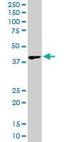 Anti-DKK1 Goat Polyclonal Antibody