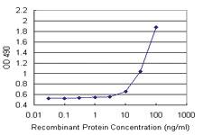 Anti-TAGLN Mouse Monoclonal Antibody (Biotin)