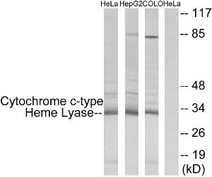 Western blot analysis of lysates from HeLa, HepG and COLO cells using Anti-Cytochrome c-type Heme Lyase Antibody. The right hand lane represents a negative control, where the antibody is blocked by the immunising peptide