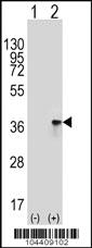 Anti-TOLLIP Rabbit Polyclonal Antibody