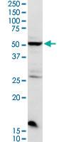 Anti-CHRDL2 Rabbit Polyclonal Antibody